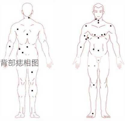 背部痣相图-第3张图片-滋味星座网