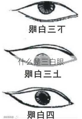 什么是三白眼