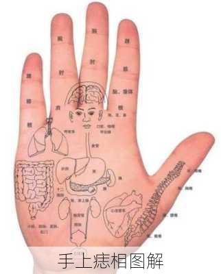 手上痣相图解-第3张图片-滋味星座网