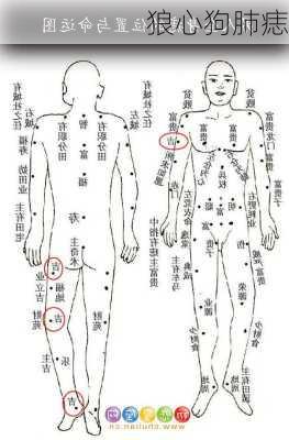 狼心狗肺痣-第3张图片-滋味星座网